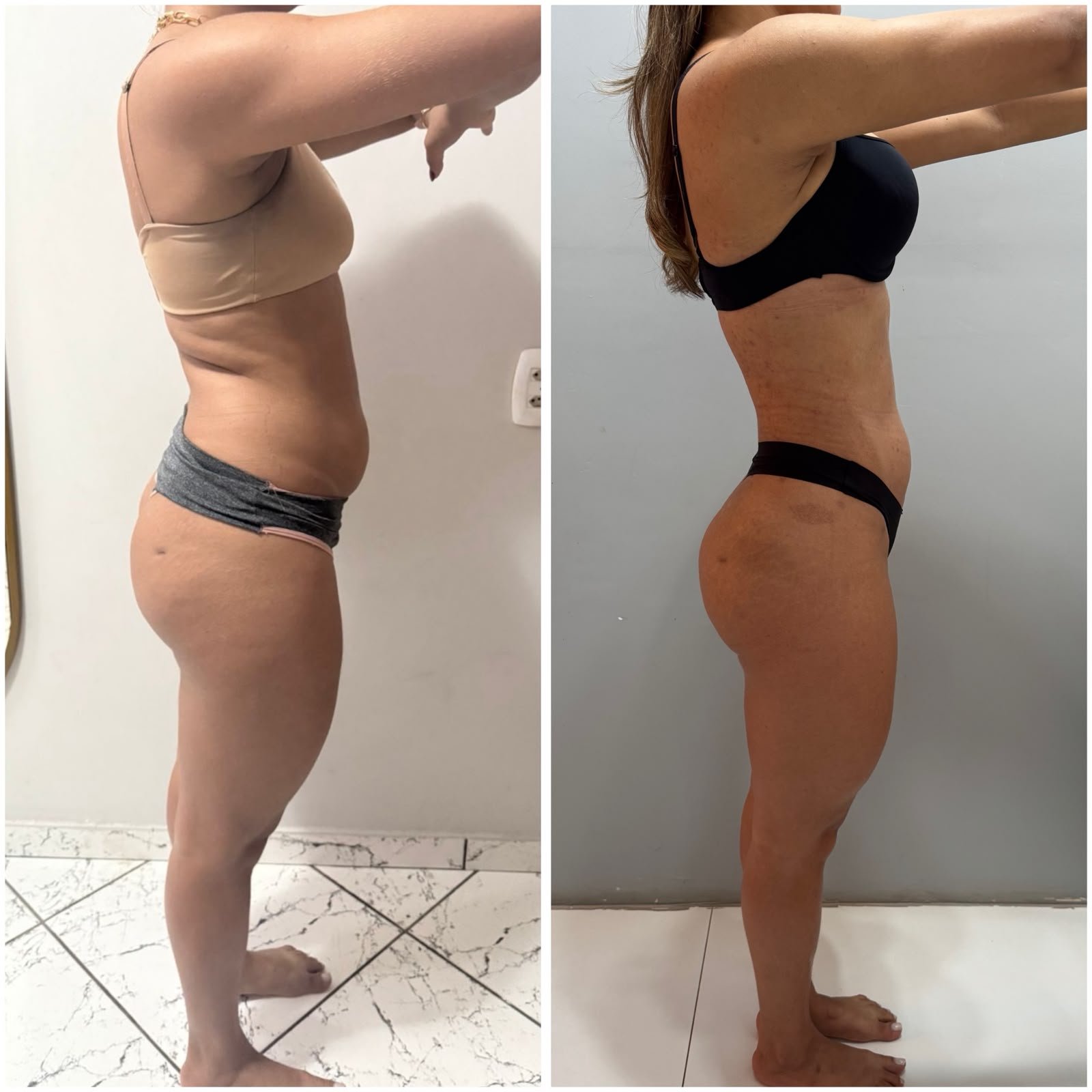 Transformação de aluna — antes e depois (3)